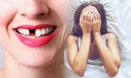 Giải mã giấc mơ rụng răng – Điềm báo tốt hay xấu? Con số may mắn là gì?